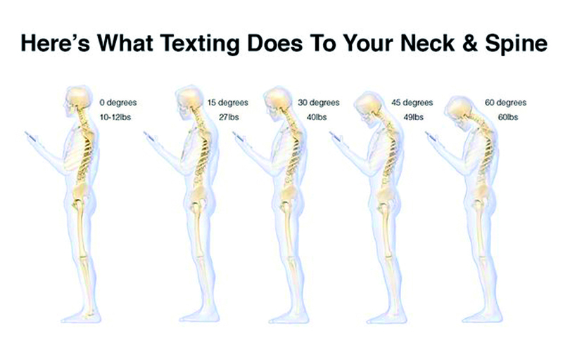 smartphone neck overload