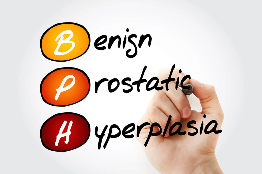 Ipertrofia prostatica sintomi: come riconoscerli e affrontarli