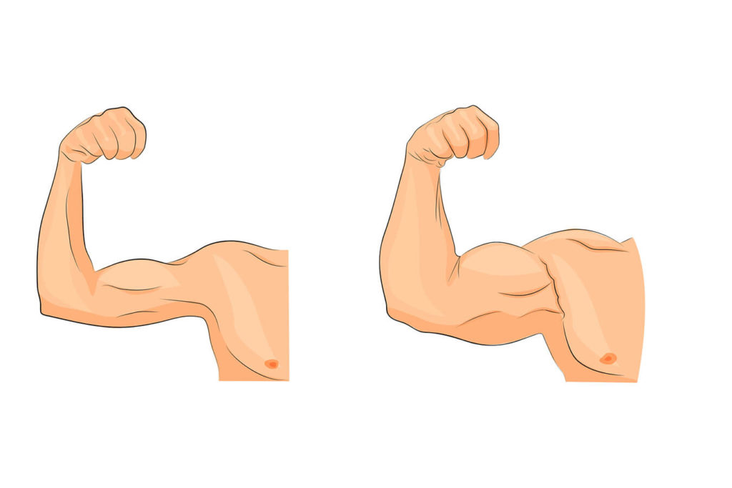 Le cause dell'ipertrofia muscolare e i fattori di rischio