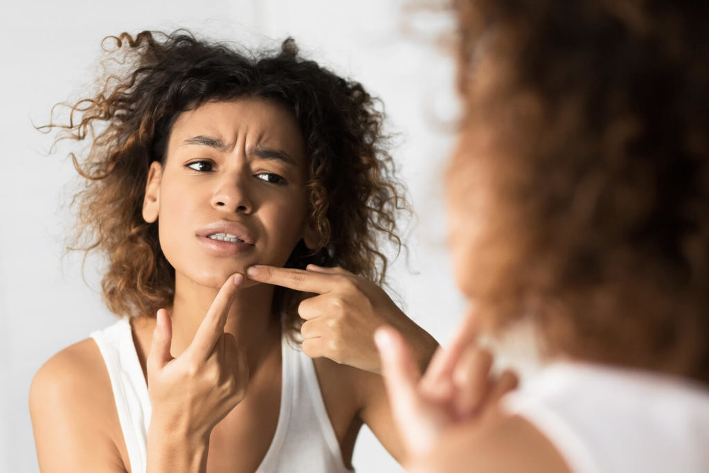 Punti neri: cause e rimedi naturali