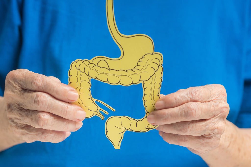 Tumore Precanceroso nel Colon: Consigli per la Prevenzione