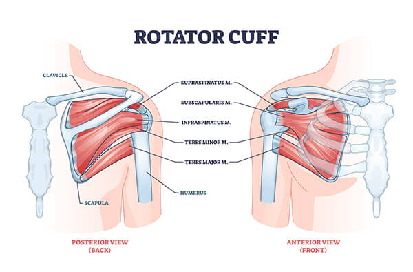 Come si Cura la Cuffia dei Rotatori