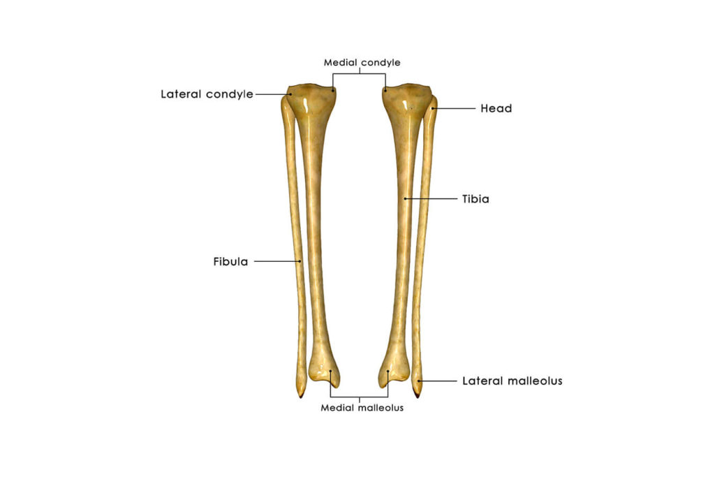 Diagnosi e Trattamento delle Lesioni alla Tibia