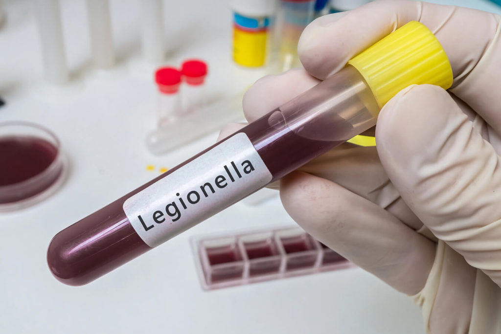 Legionella: Comprendere, Trattare e Prevenire l'Infezione
