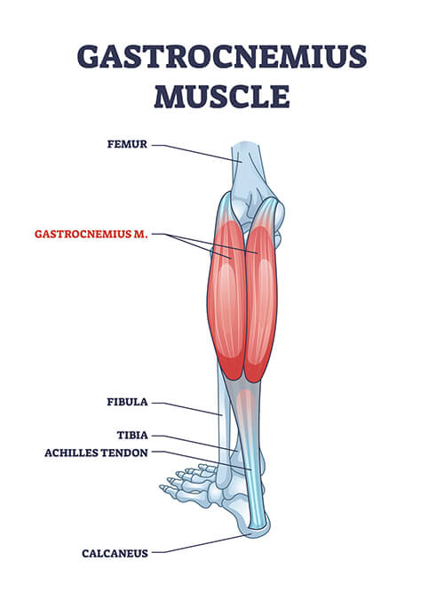 Come curare il muscolo gastrocnemio