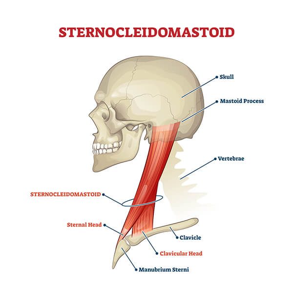 Sternocleidomastoideo Cosa E A Cosa Serve La Palestra Sternocleidomastoideo Cosa E A Cosa Serve La Palestra