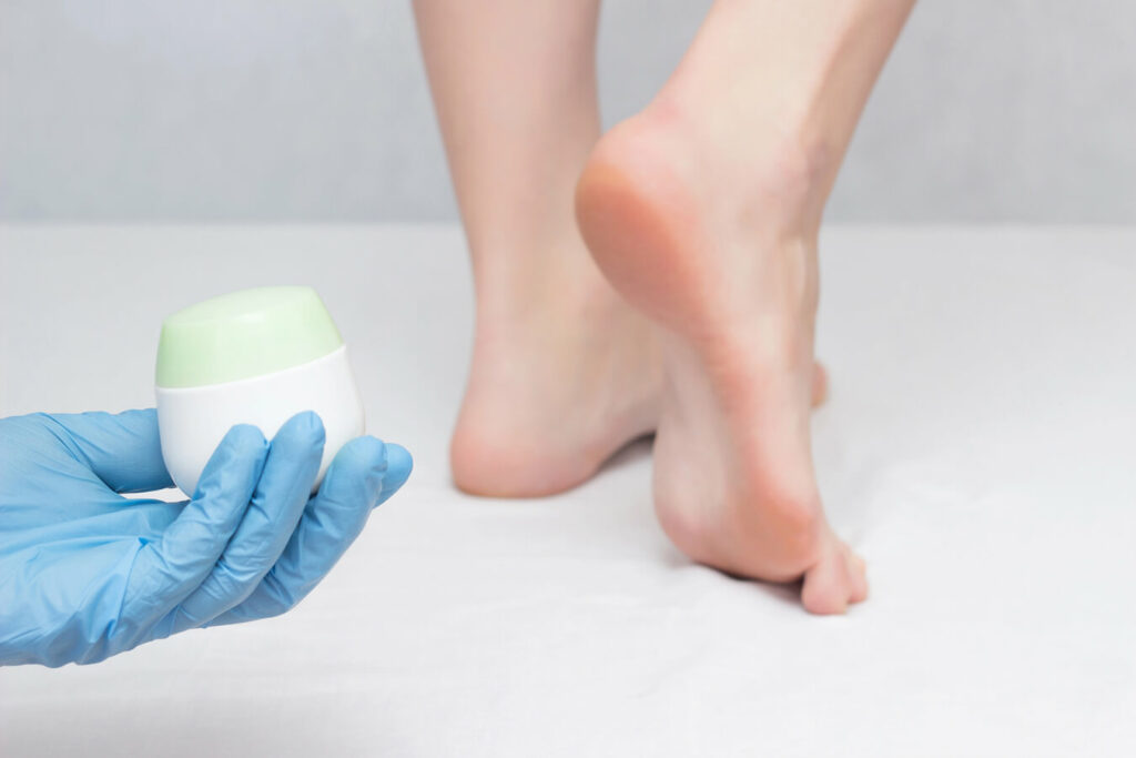 Bruciore alla pianta del piede: cause, rimedi e prevenzione