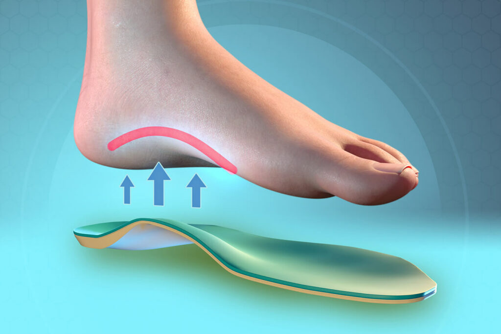 Plantari per postura corretta: come funzionano e perché usarli